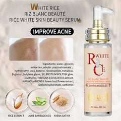 AILKE Multi-Vitamin Whitening Body Lotion, Moisturizes, Nourishes, Removes Dark Spots, Blemishes, Hyperpigmentation