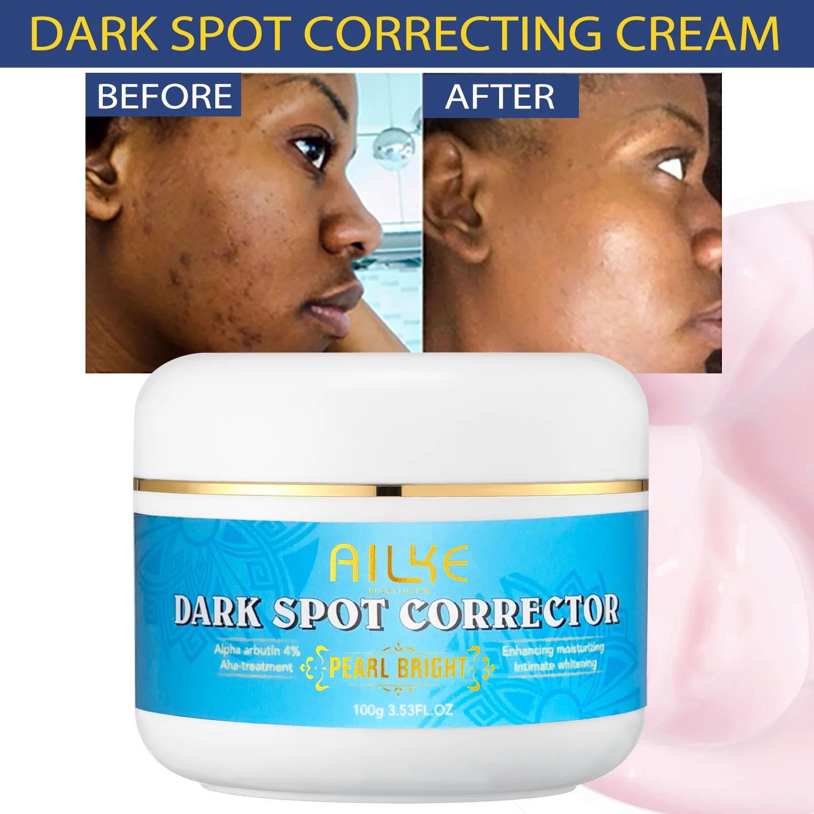 dark-spot-remove